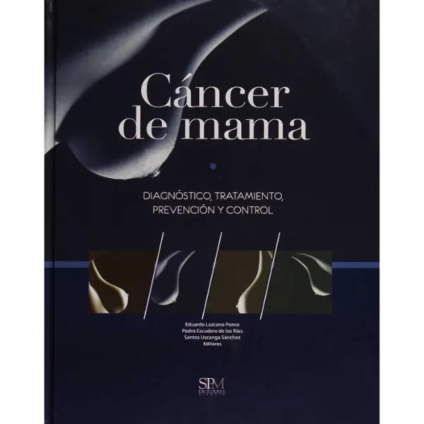 Libro Cáncer de Mama Diagnóstico, prevención y control
