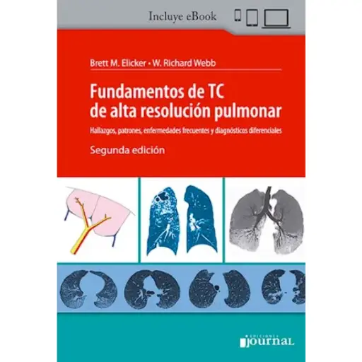 Libro Fundamentos de TC de alta resolución pulmonar 2.ª Edición.