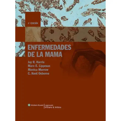 Libro Enfermedades de la mama 4.ª Edición.