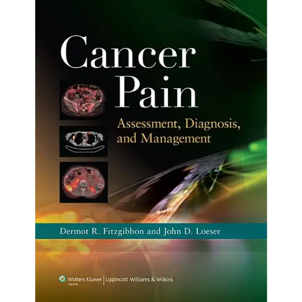 Libro Cancer Pain: Assessment, Diagnosis, and Management