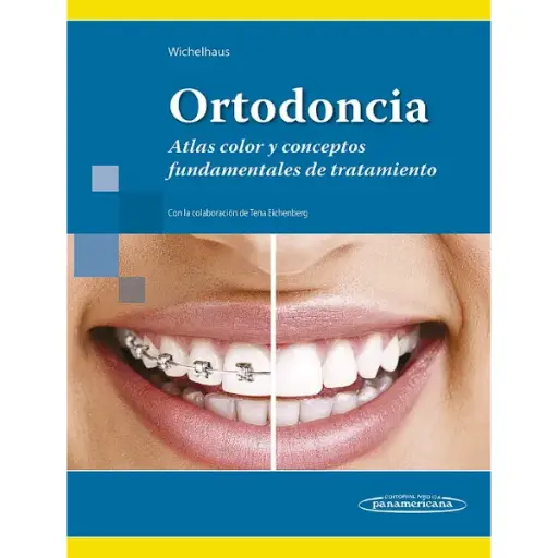 Libro Ortodoncia (Atlas color y conceptos fundamentales de tratamiento)