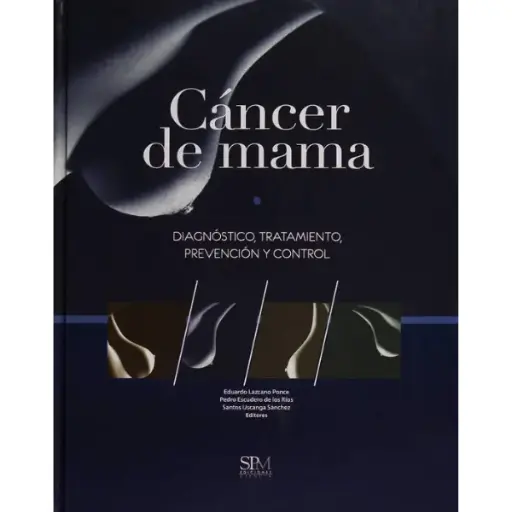 Libro Cáncer de Mama Diagnóstico, prevención y control