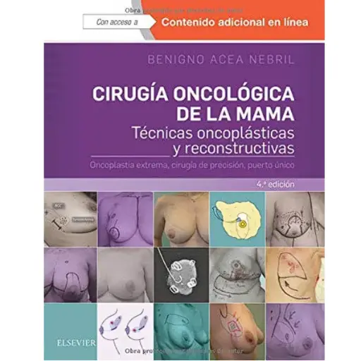 Libro Cirugía oncológica de la mama 4.ª Edición