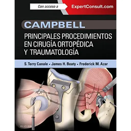 Libro Campbell. Principales procedimientos en cirugía ortopédica y traumatología