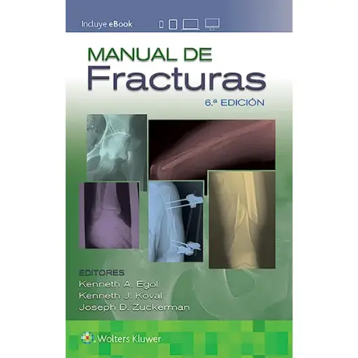 Libro Manual de Fracturas 6.ª Edición